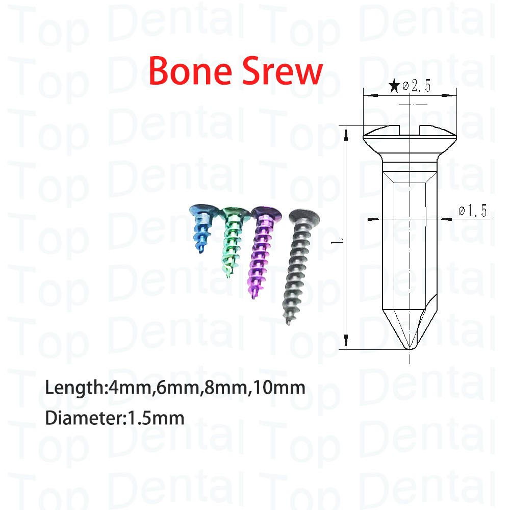 10 szt. Śrubek kostnych GBR Sy – Stabilizer Screw In recenzja i cena